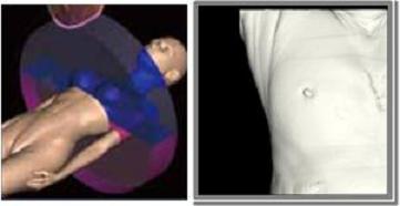 胸(乳腺)にかかるX線を抑えます